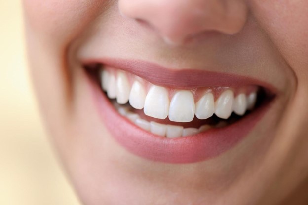 A Beautiful Smile With Charismatic Teeth  A Beautiful Smile With Charismatic Teeth