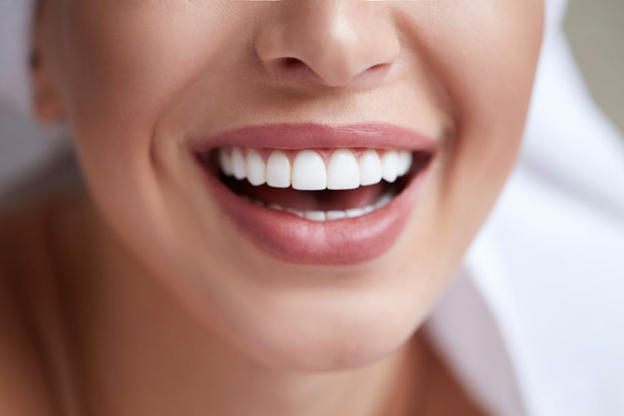 A Radiant Smile of a Woman Featuring Flawless White Teeth  A Radiant Smile of a Woman Featuring Flawless White Teeth
