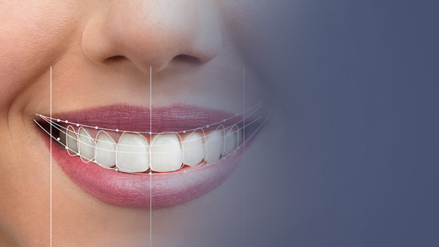  Demonstration of Digital Smile Design Dentistry at Smile Cafe for
Your Hollywood Smile