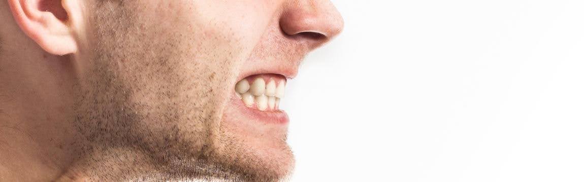 A Man With a TMJ Disorder, Grinding His Teeth  A Man With a TMJ Disorder, Grinding His Teeth