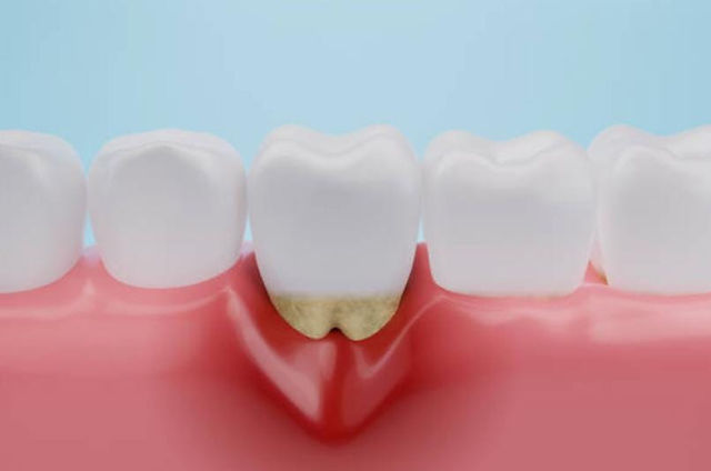 Smile Cafe NY Smile Cafe NY