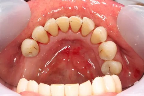 Smile Cafe NY Smile Cafe NY