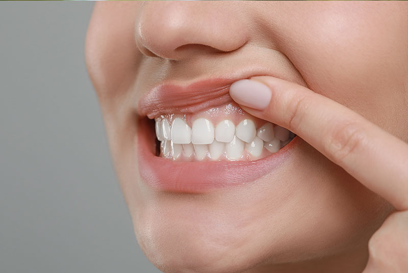 Smile Cafe NY Smile Cafe NY