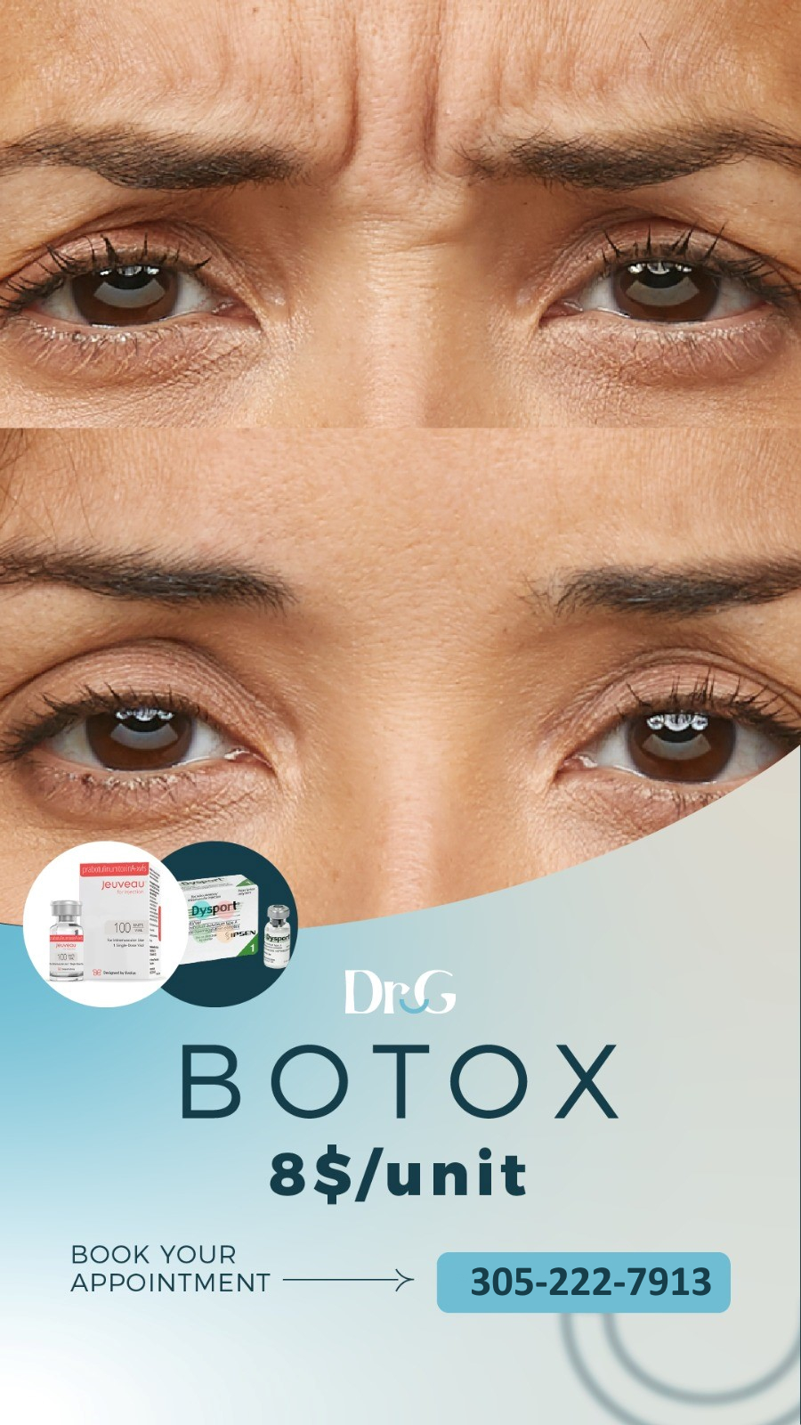 Botox Injectables in Miami FL 8 per unit cheapest Allergen