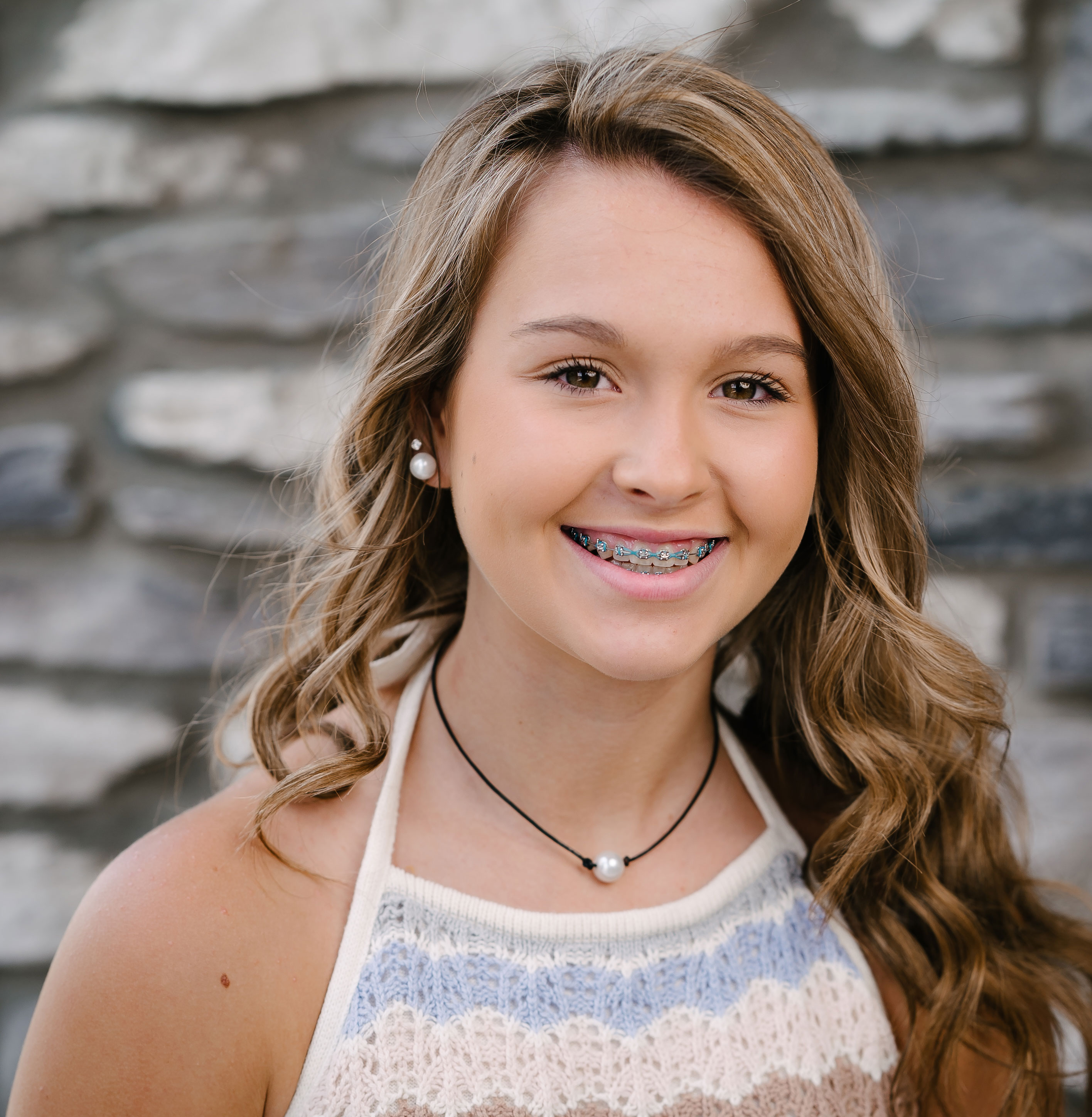 Braces (In One Day) Lawless Orthodontics Bowling Green, KY & Glasgow