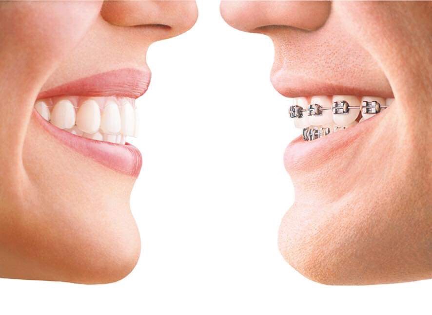 Orthodontics General and Cosmetic Dentistry of Tampa Randall Diez