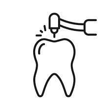 Root Canals