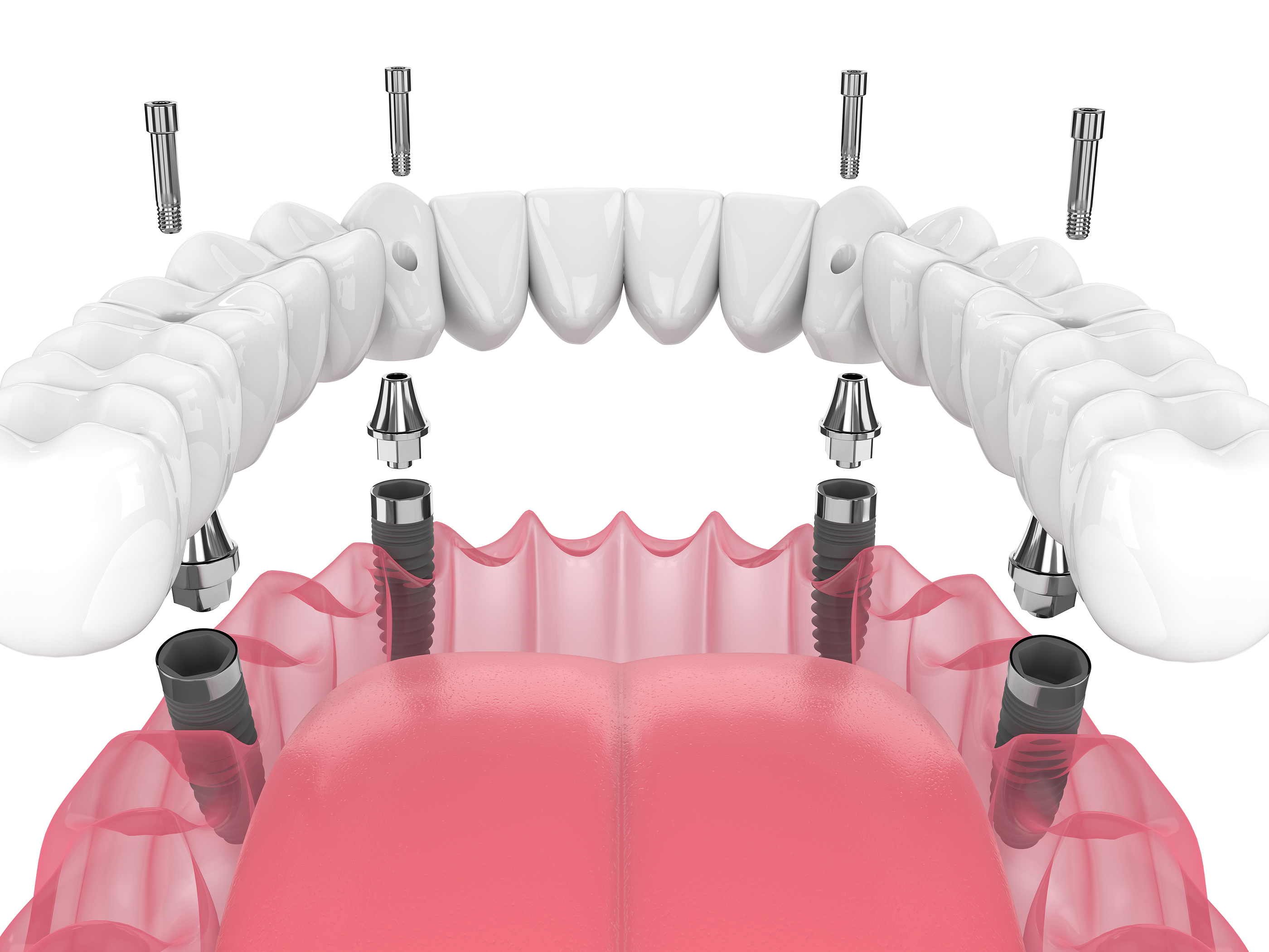 SoCal Oral and Maxillofacial Surgery SoCal Oral and Maxillofacial Surgery