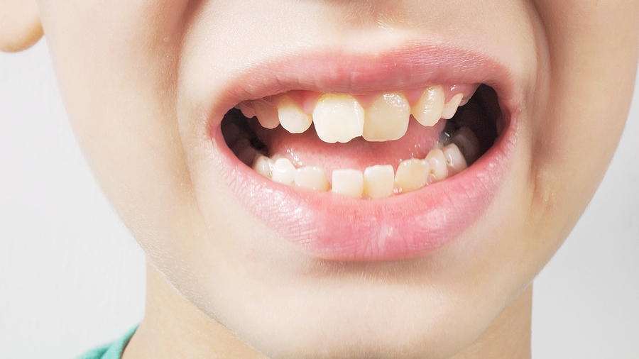 dental emergencies in Roslyn and New York