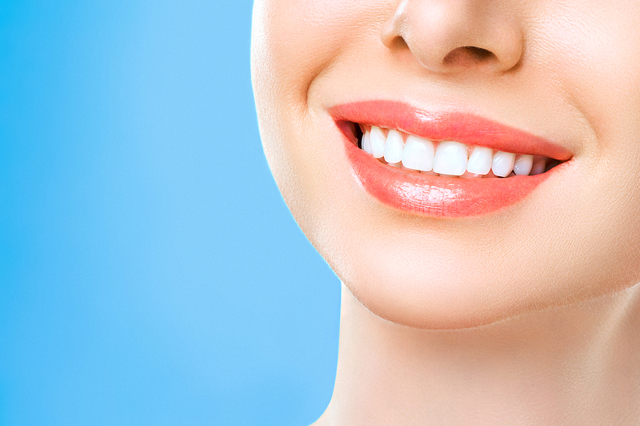 This is a thumbnail image of blog Brighten Your Smile: The Benefits of Opalescence Boost Teeth Whitening in Kilgore, TX