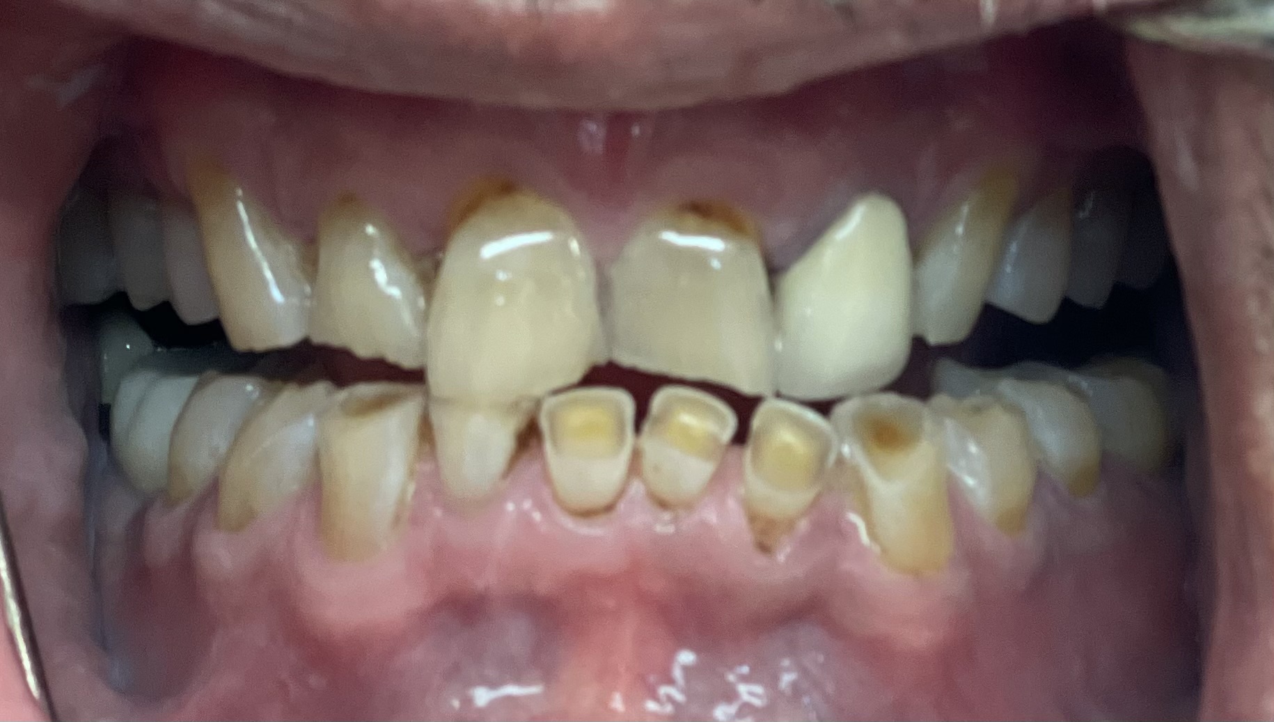 Newnan dental care