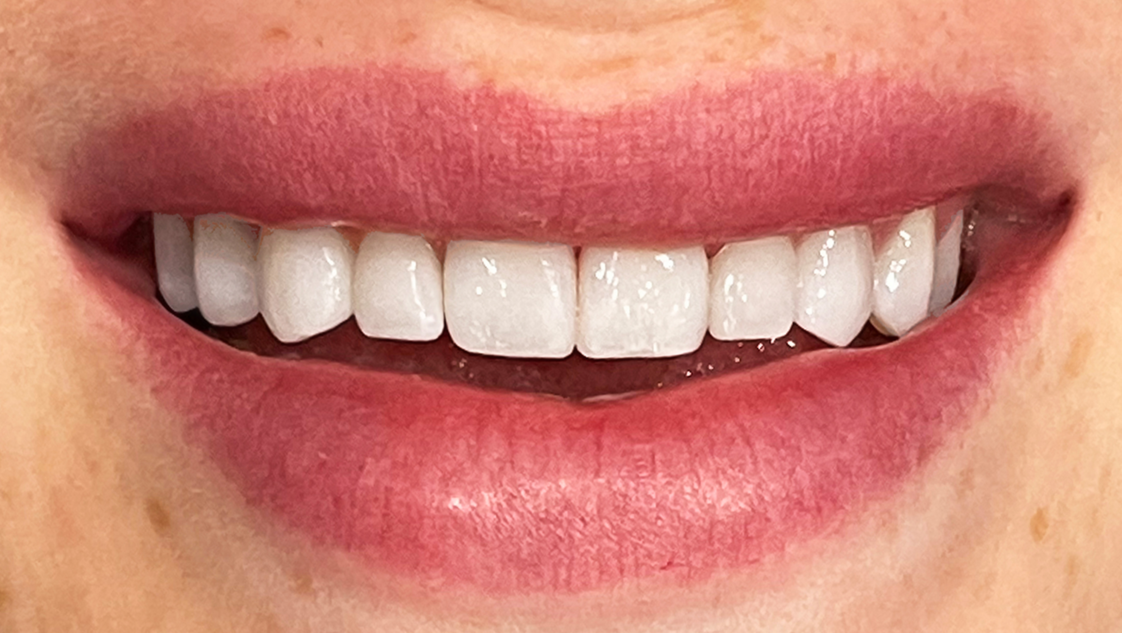 Gallery Hlavaty Dental Arts Santa Barbara, CA