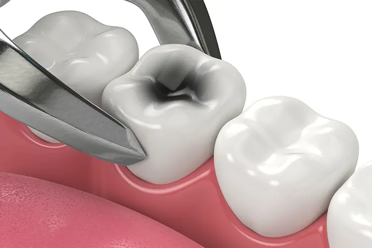 Kentucky Center for Oral and Maxillofacial Surgery  Kentucky Center for Oral and Maxillofacial Surgery