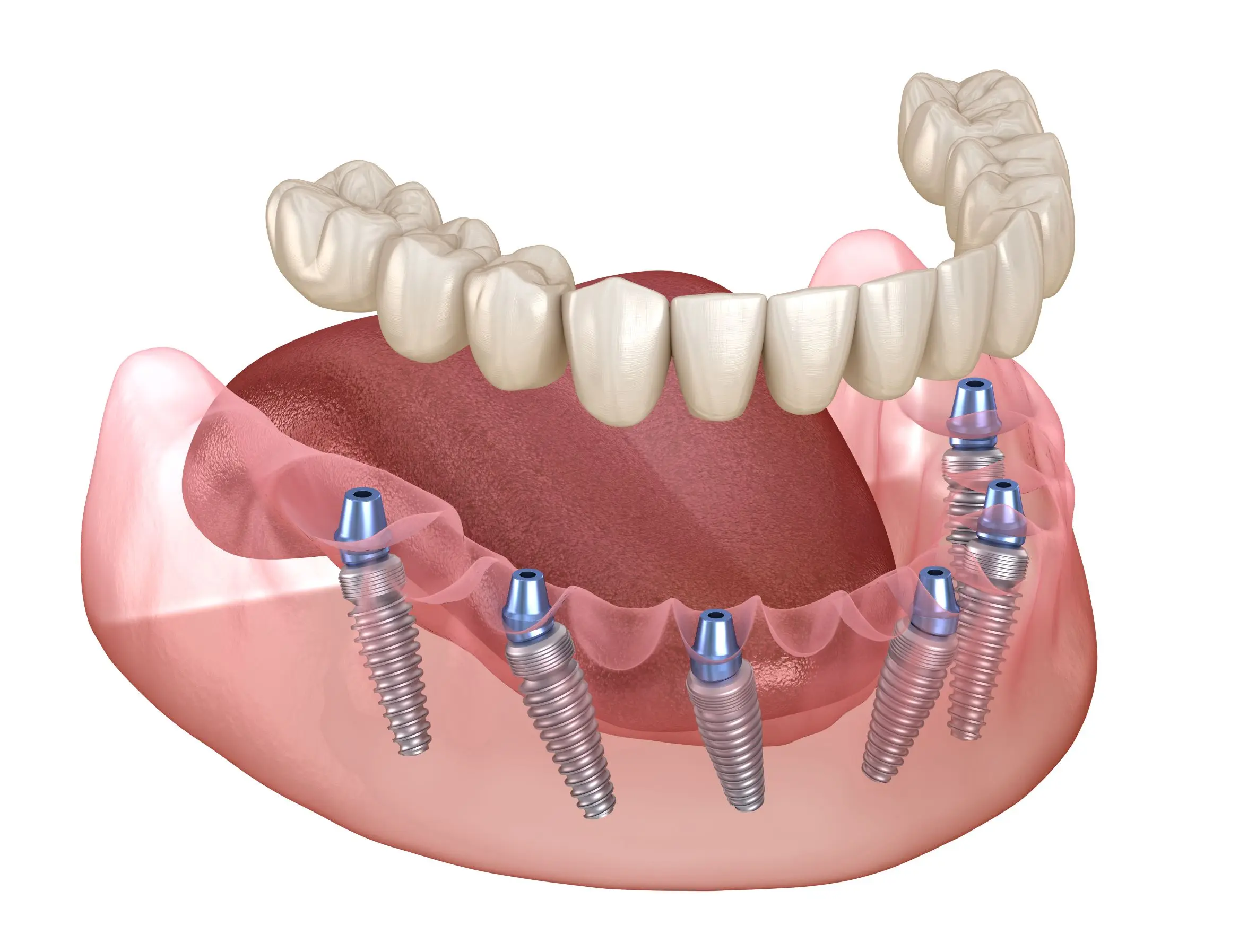  Cumberland Surgical Arts and Associates, PLLC