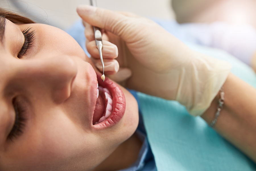 When do I need a root canal?